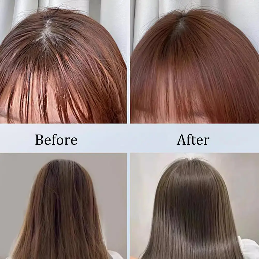 1/3/5PCS 60g Black Castor Shampoo Bar 2-in-1 Shampoo and Conditioner, made with castor extract, nourishes and cares for all hair - view 6