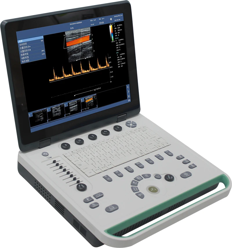 C5mini Portable Laptop Color Doppler Ultrasound Machine System+convex array probe