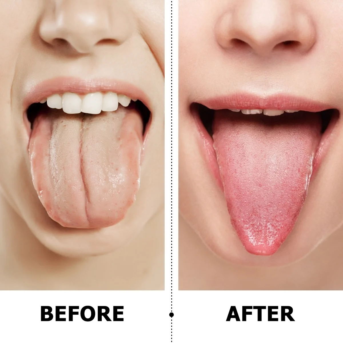 

10Pcs Tongue Scraper Cleaner Metal Plastic Both Sides Used Remove 95 Mouth Odor Dirt Gift Family Tongue Scraper