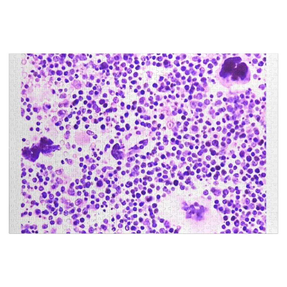 

Bone marrow Jigsaw Puzzle Wooden Decor Paintings Custom Child Gift Personalized Toy Puzzle