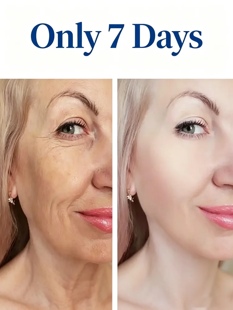 Niacinamide facial serum helps diminish fine lines, improve skin texture beyond daily cleansing, and even out skin tone.
