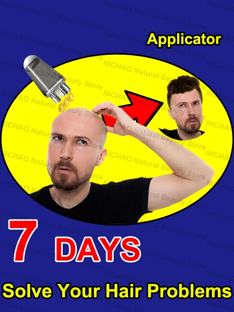 

7 Days Fast Hair Growth Essential Loss Regrowth Treatment Strengthens Hair Nourishes Scalp Light Weight Non Greasy