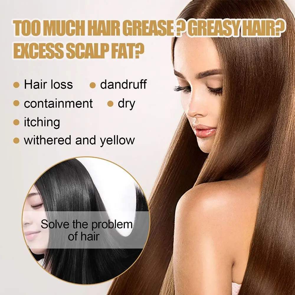 

New Practical Smoothing Natural Ginger Hair Regrowth Soap Anti Hair Loss Shampoo Soap Hair Growth