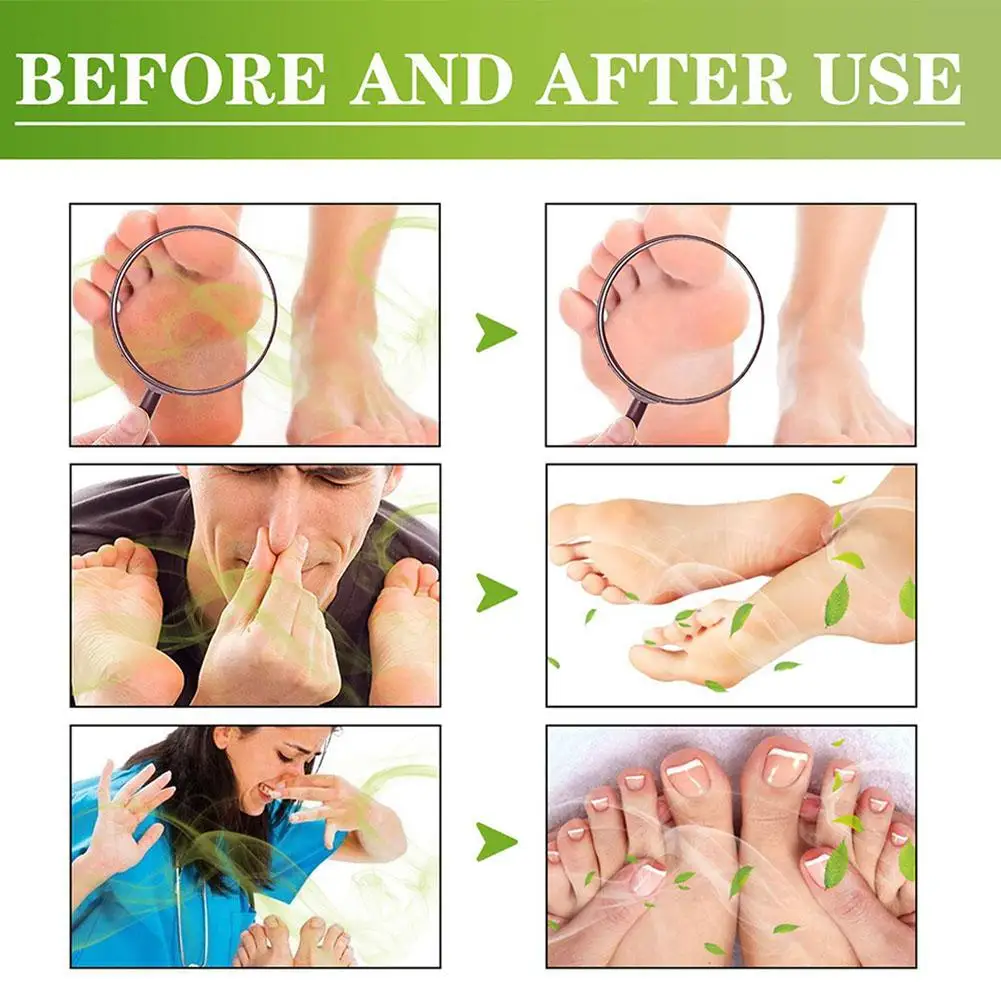 مزيل رائحة الأحذية بخاخ القدم للأقدام المتعرقة ومزيل الروائح الكريهة للأحذية الطبيعية ورذاذ القدم الذي يحيد رائحة القدم الكريهة يدوم طويلاً