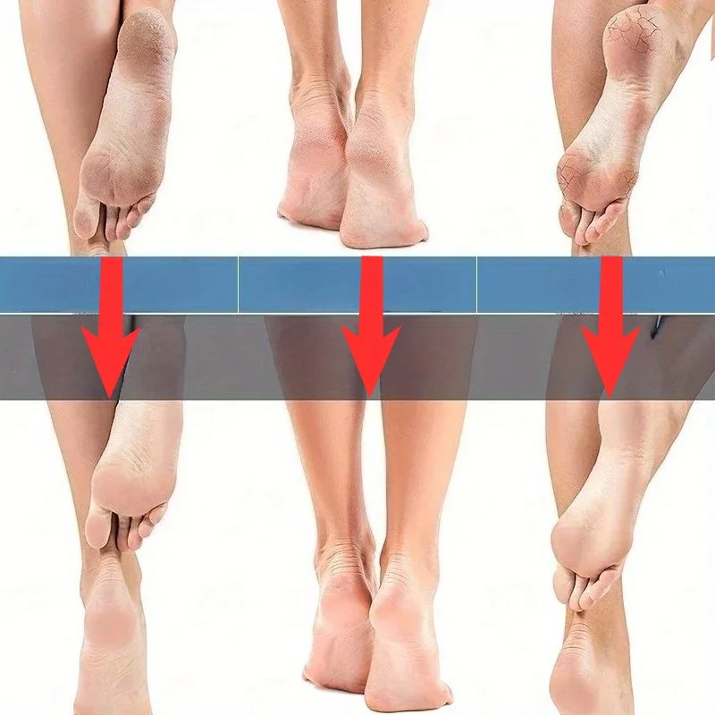 Nano Glass Foot Grinder Foot File Dead Skin Callus Remover Foot Scrubber Heel Exfoliating Feet Rasp Pedicure Tools Feet Care - view 4