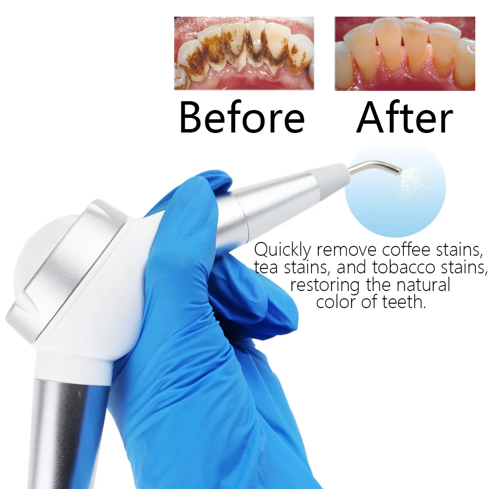 

M&Y Dental Prophy Jet Air Polishing Unit System Autoclavable Dental Detachable Spray Polish 2/4holes dentistry tools