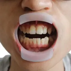 1 sztuk Dental o-kształt wewnątrzustna Lip Cheek zwijacz otwieracz do ust higiena jamy ustnej wybielanie zębów ekspandery ortodontyczne Brace narzędzia