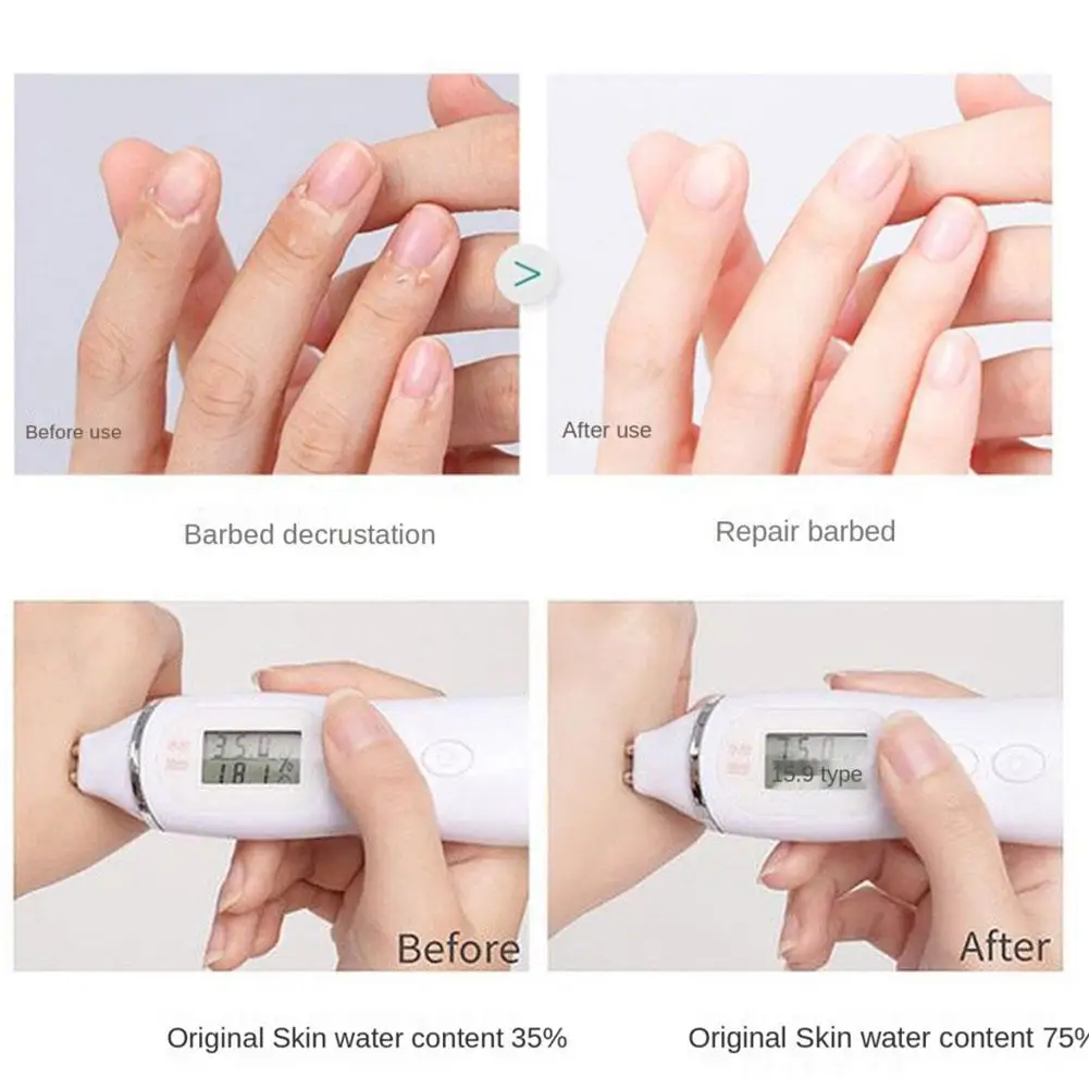 40ml di acido ialuronico essenza per le mani crema idratante per le mani ammorbidente siero antigrasso per le mani antigrasso Y9C2