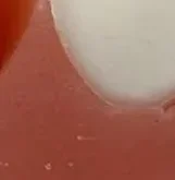 

Dental Implant Parallel Pin Gauge Stainless Steel Medical Locator Dental Implant Locating Guide Locating Ruler