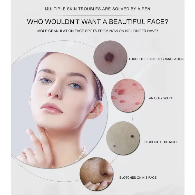 الاستخدام المنزلي باليد البلازما EMS التكنولوجيا تبييض تنظيف البقع الداكنة إزالة الشامات شد الوجه تجديد الجلد USB #3