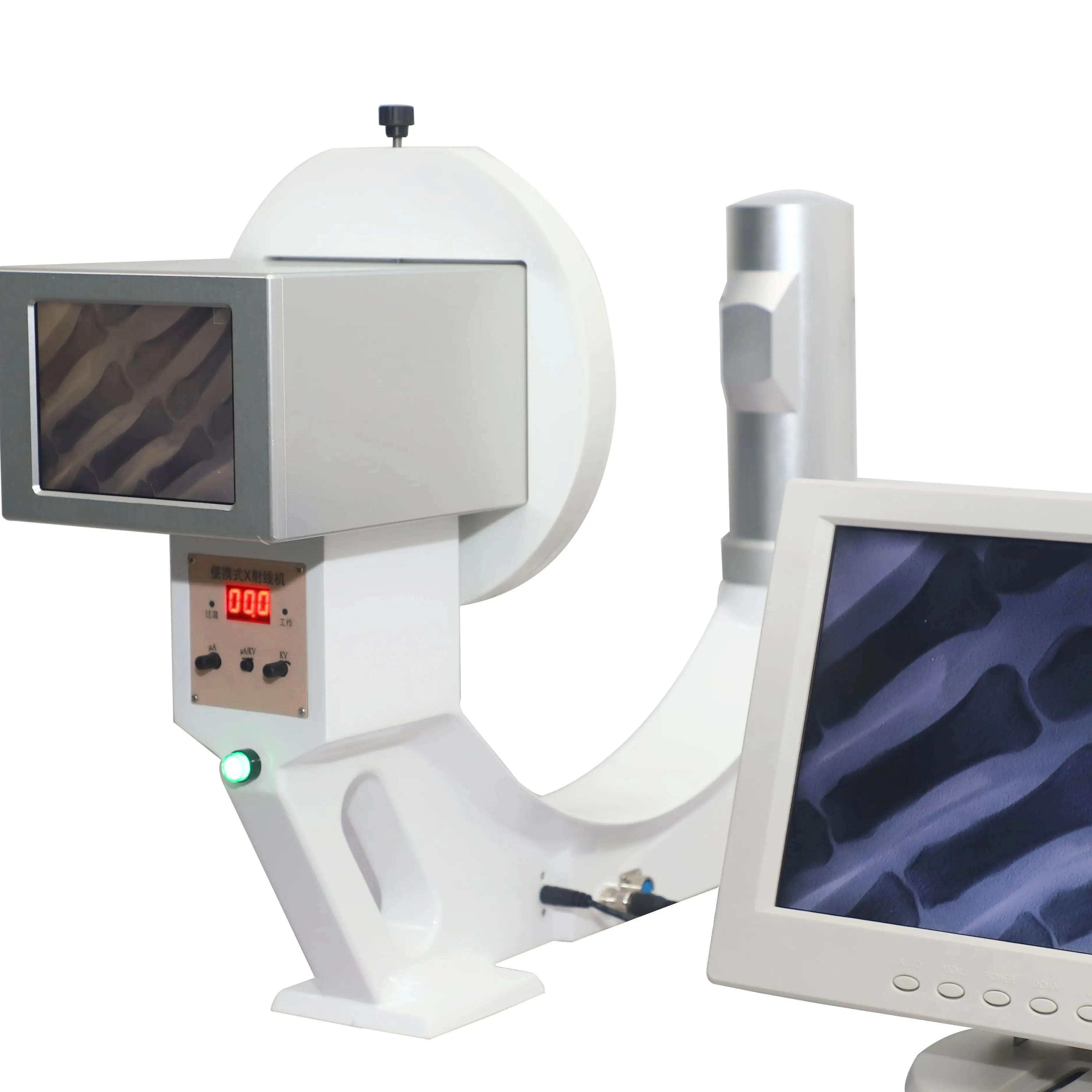 Goedkoopste Draagbare X-Ray Machine Handheld Fluoroscopie Machine Prijs Voor Verkoop