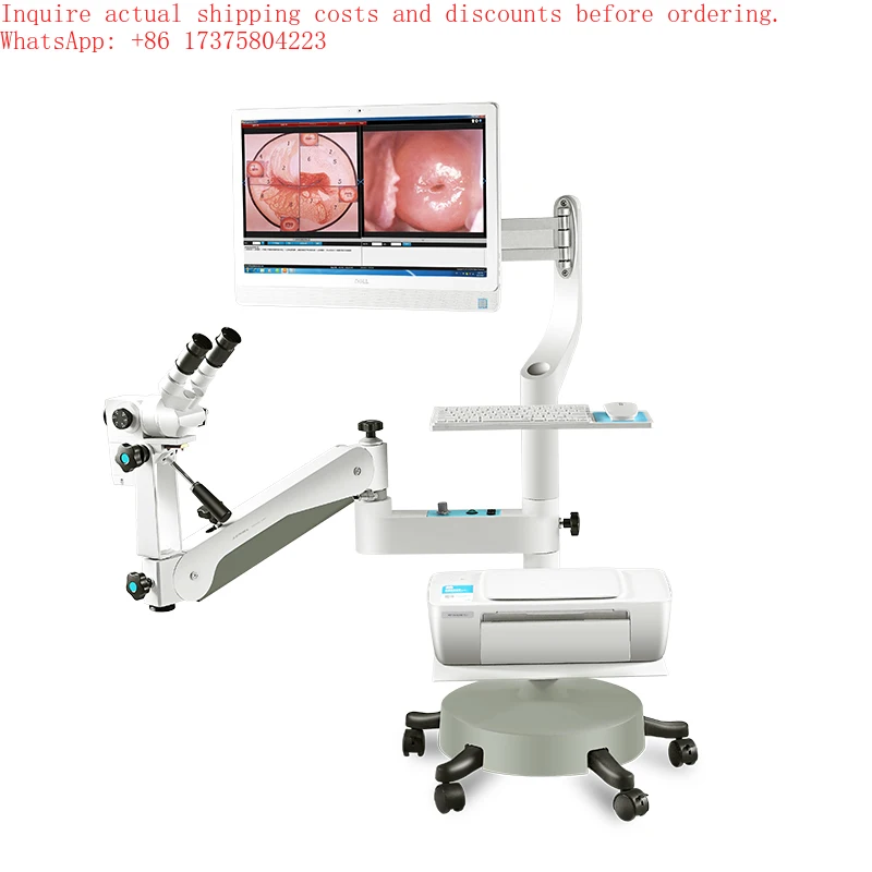 KN-2200 Series Optical Colposcopy Cervical Colposcopy Equipment for Hospital Gynecological HPV Examination