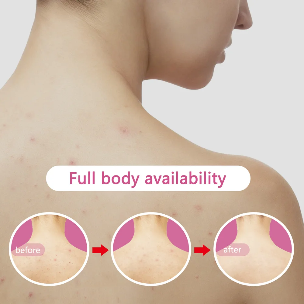 2025 Draagbaar plasma ozon-ion gezichtsmassager schoonheidsapparaat