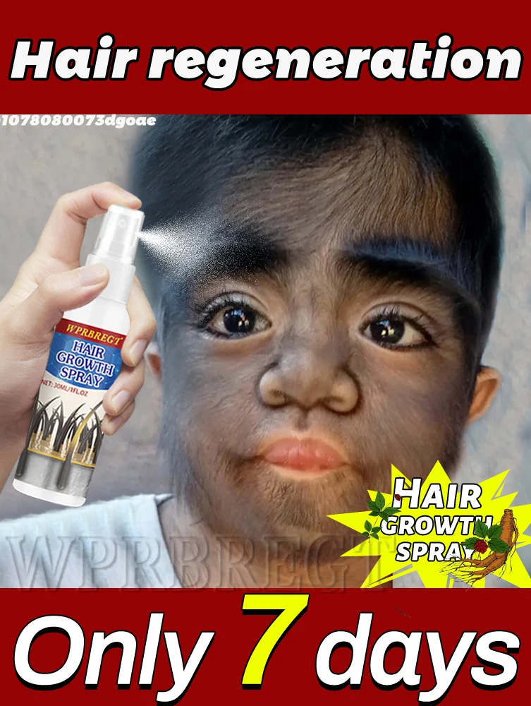 

(Hot-Selling)Ginger Hᴀɪʀ Gʀᴏᴡᴛʜ Spray (30ᴍʟ) Deeply Repairs Hair Follicles, Thickens Hair in 72 Hours