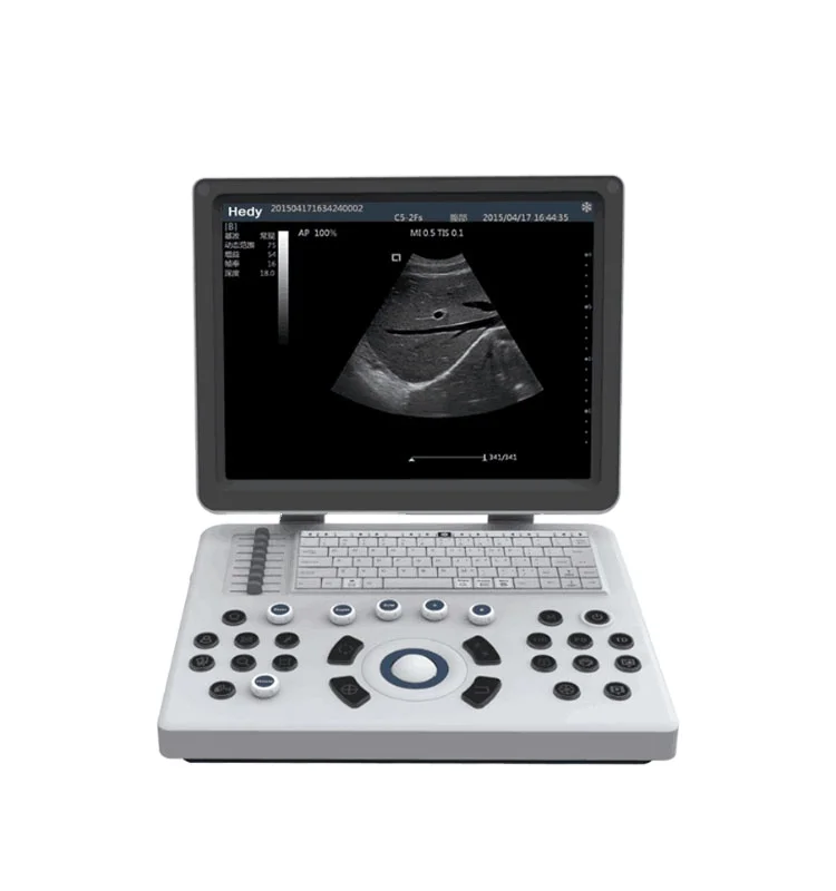 Hedy medical color doppler ultrasound portable CW TDI cardiac portable ultrasound