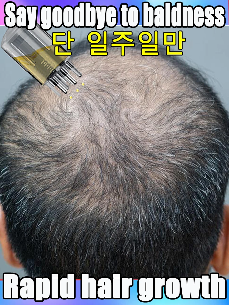 

say goodbye to baldness, thick hair