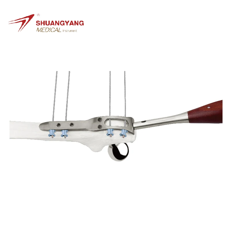 Shuangyang Medical Lowest Price Orthopedic Cable Orthopedic Implants Plate Prosthesis And Revision Femur Locking Plate