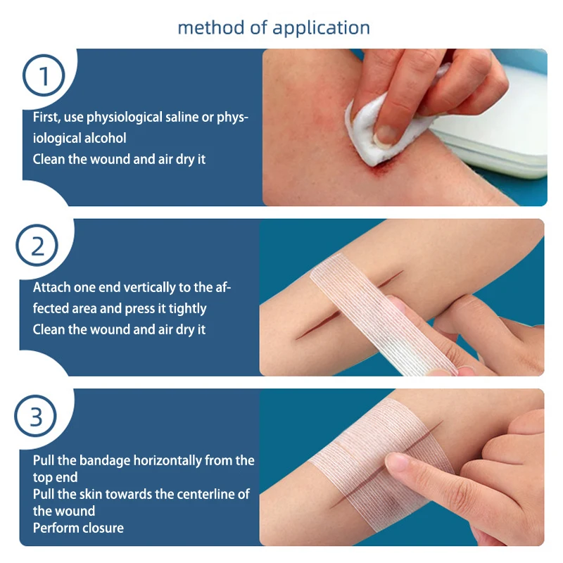 شريط لاصق سلس ، ناعم وصديق للبشرة ، قماش غير منسوج ، جيد التهوية ، تخفيف التوتر ، ضمادات ذاتية اللصق ، 2 *