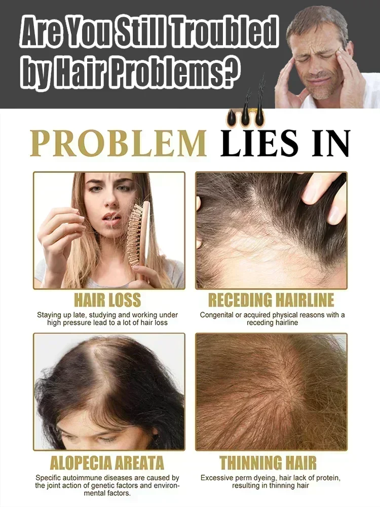 Contains hair growth magic, let the hairline back to confidence, say goodbye to hair trouble. Hair tonic