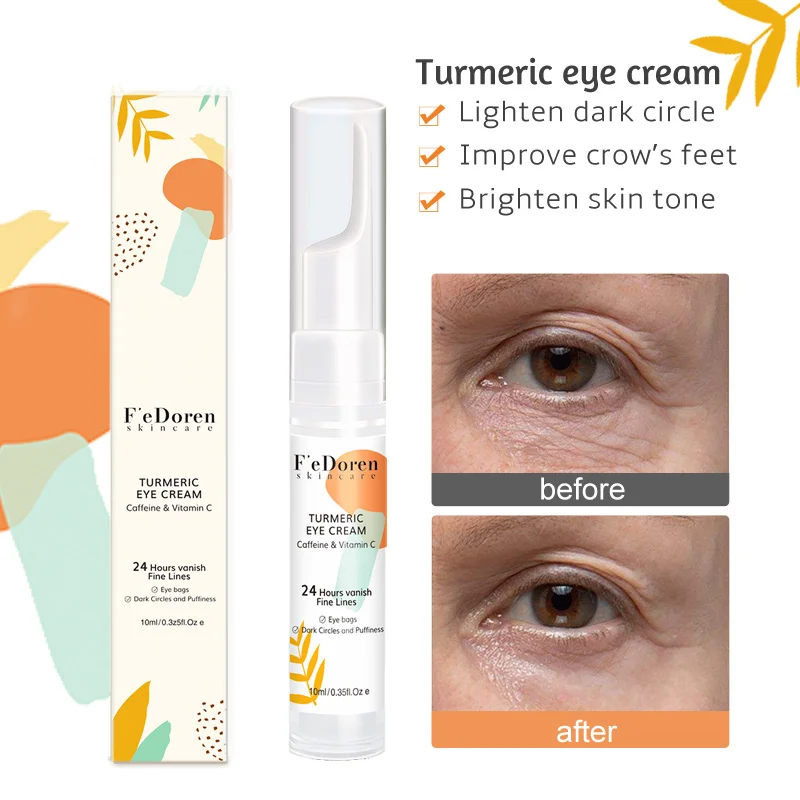 Turmeric Anti Dark Circles Fat granules Eye Cream Fades Fine Lines Wrinkle Remove Female Eye Bags VC Anti Aging Firmness skin