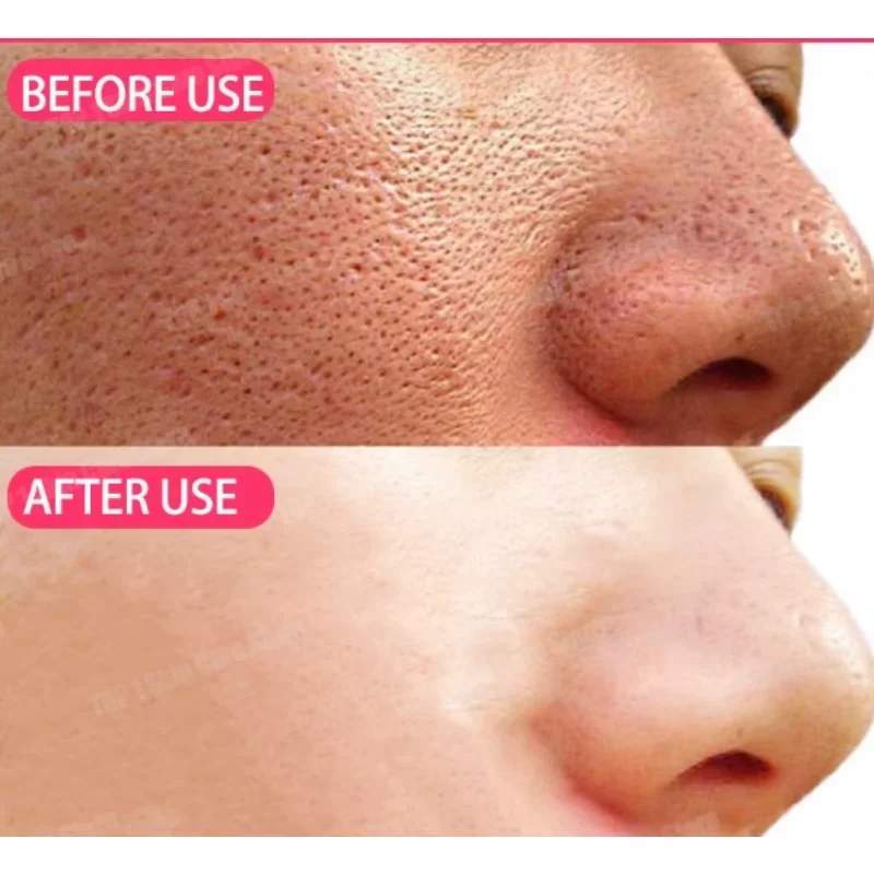 

Facial Pore Minimizing Serum for Repairing and Tightening Face; Beauty Skin Care Essence Pore Smoothing