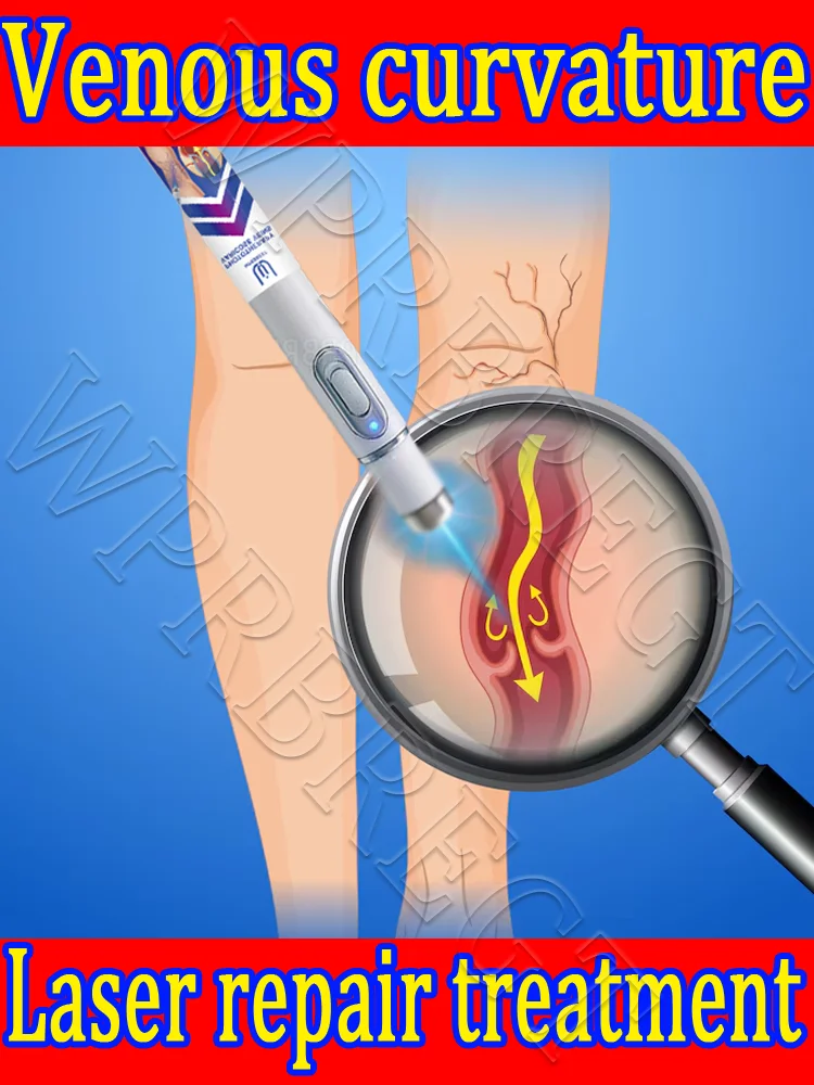 

Long-term sitting promotes blood circulation and laser treatment of varicose veins