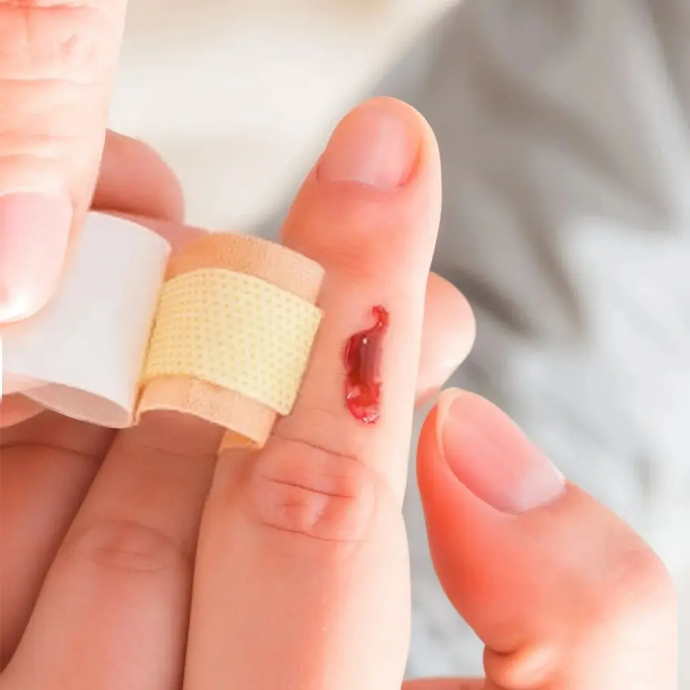 

100 шт./компл., нетканые пластыри, дышащая лента для оказания первой помощи, пластырь для повязки на рану, клейкие бинты