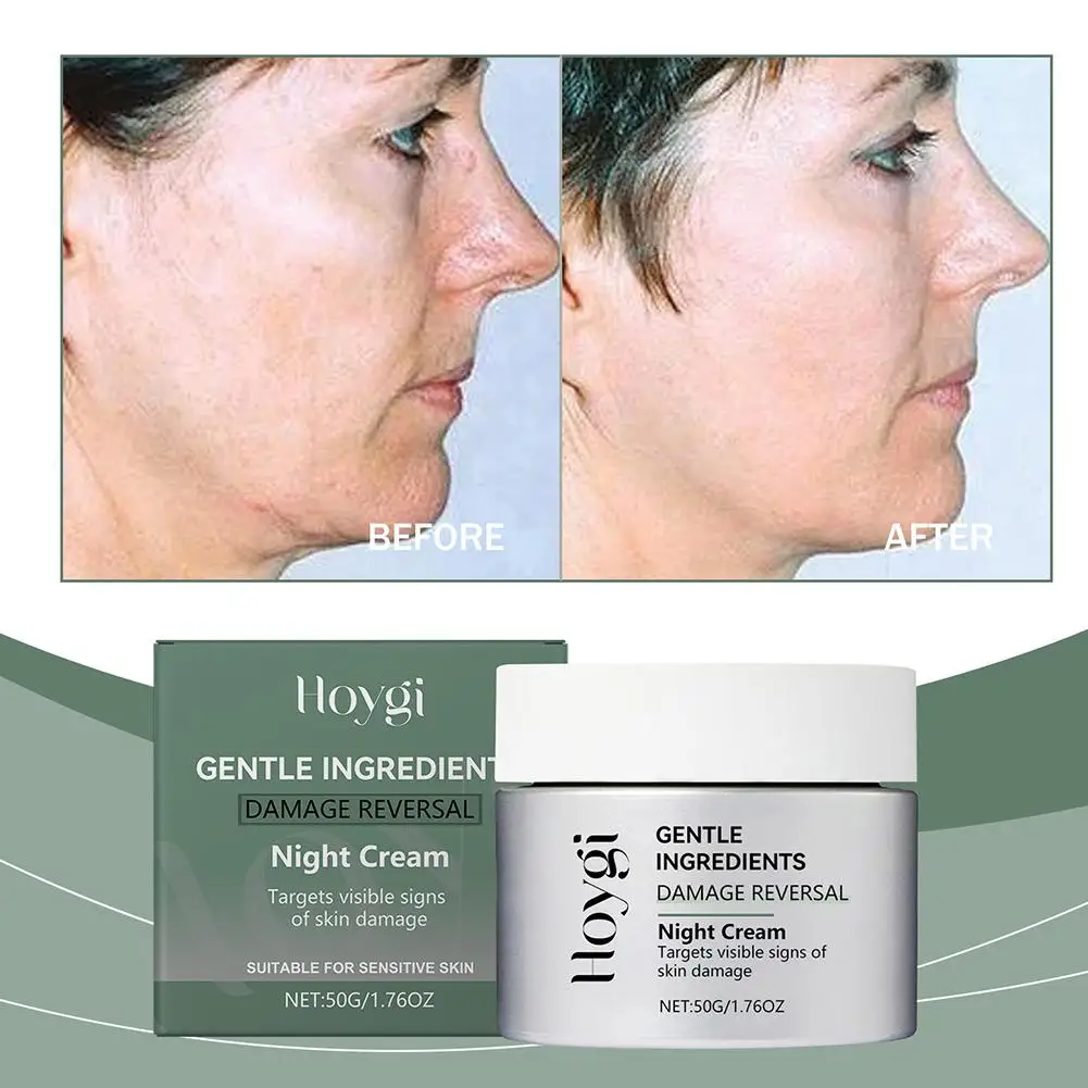 

Hydrating Firming Moisturizing Night Cream Night Care Elastic Lock Woman Care Cream Hydrating Skin Cream Face Face I2S9