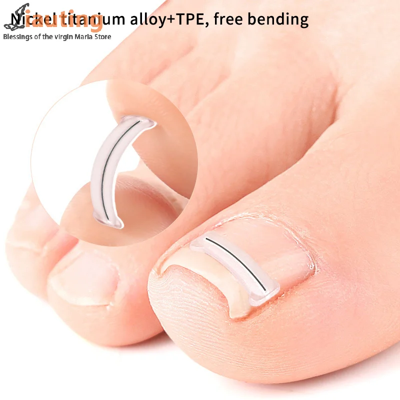 2Pcs Nagel Korrektur Aufkleber Eingewachsene Zehennagel Corrector Patches Paronychie Behandlung Erholen Corrector Pediküre Werkzeuge Fuß Pflege