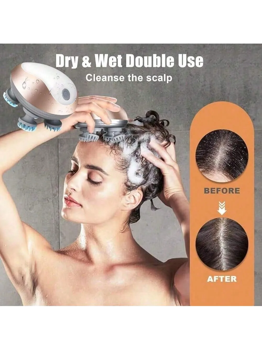 

2026 массажер для кожи головы, мини-когти осьминога, зарядка рук, многофункциональный разминающий вибрационный массажер, массажер для головы, перезаряжаемый