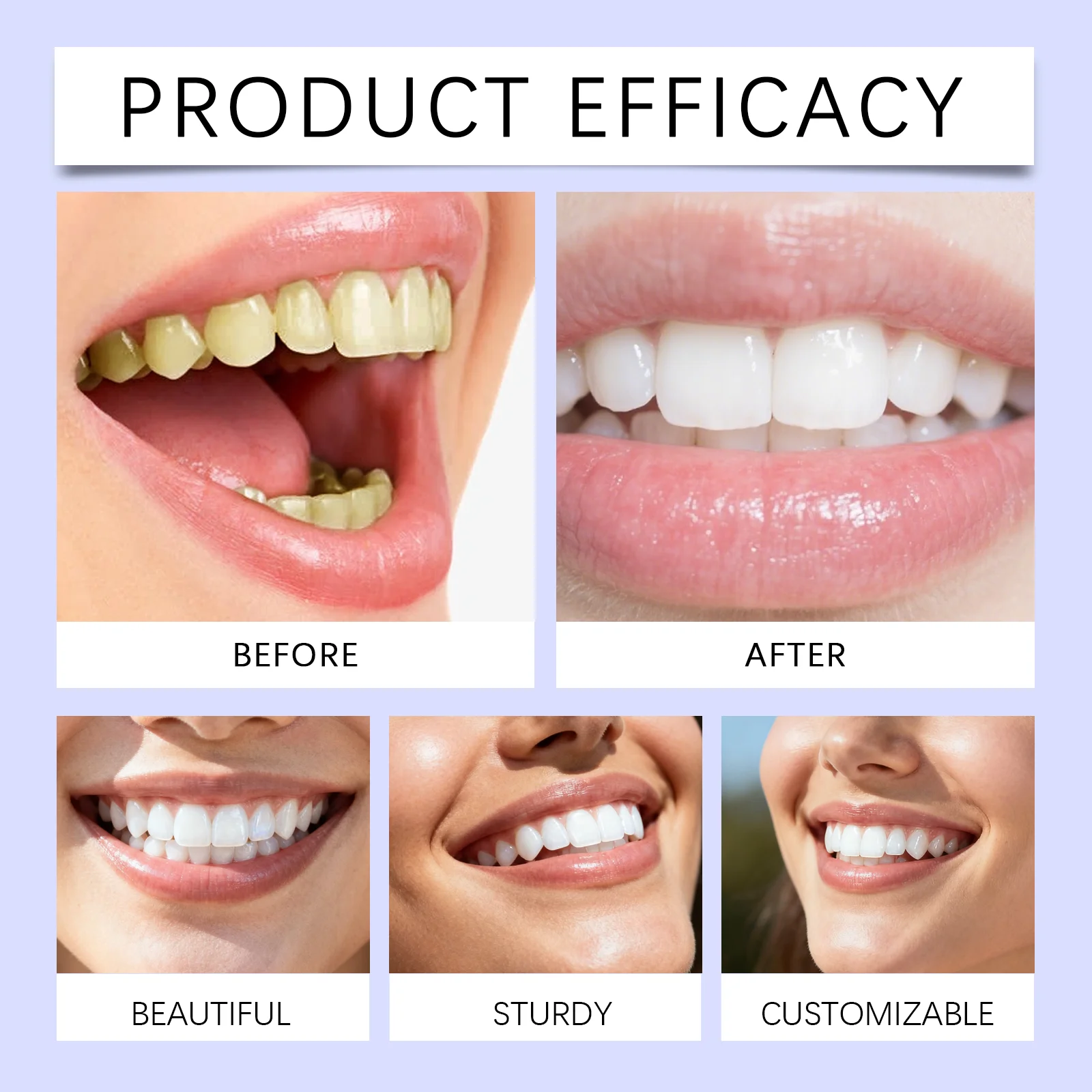 Thumbnail 4 - #47 Latest Teeth Whiteners Offers