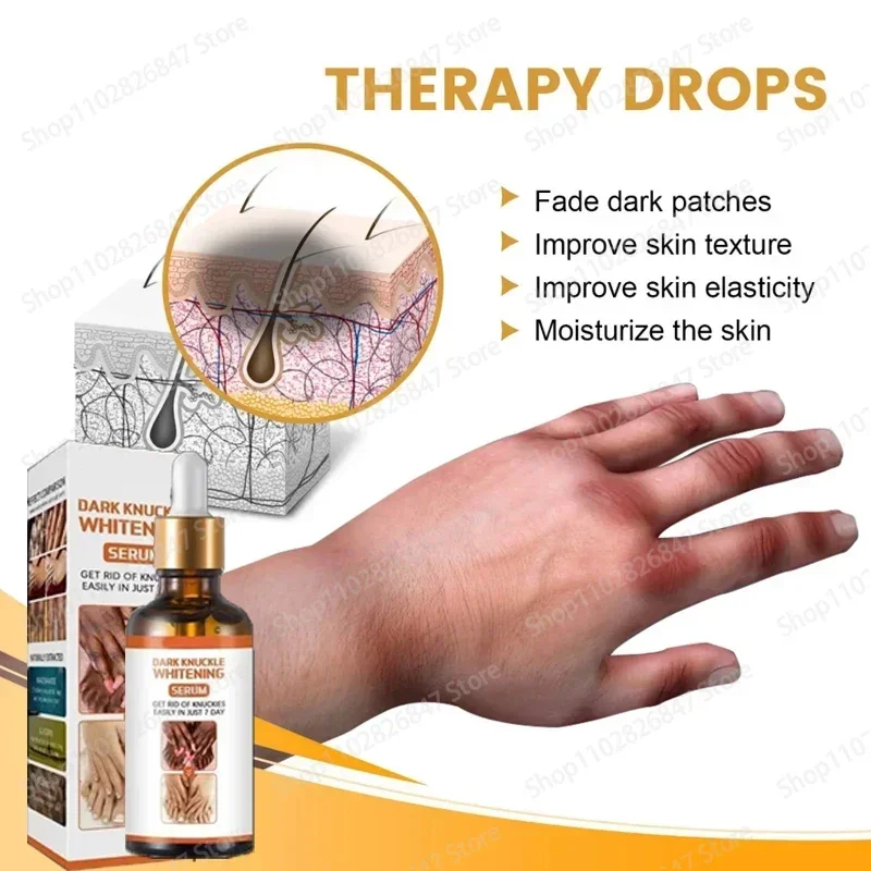 40fashion knuckles whitening Dark Skin Armpit Lightening Intimate Areas Underarm Body Skin Care Private Parts Whiten Cream Beaut