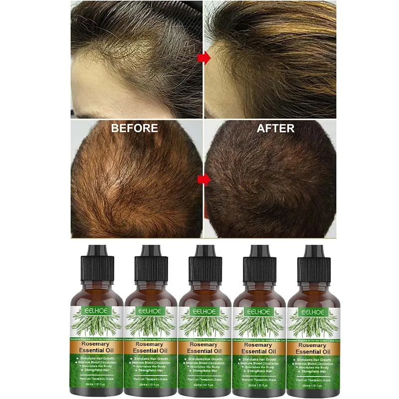 

Rosemary Hair Growth Essential Oil for Natural Nourishment, Hair Loss Prevention and Hair Root Strengthening