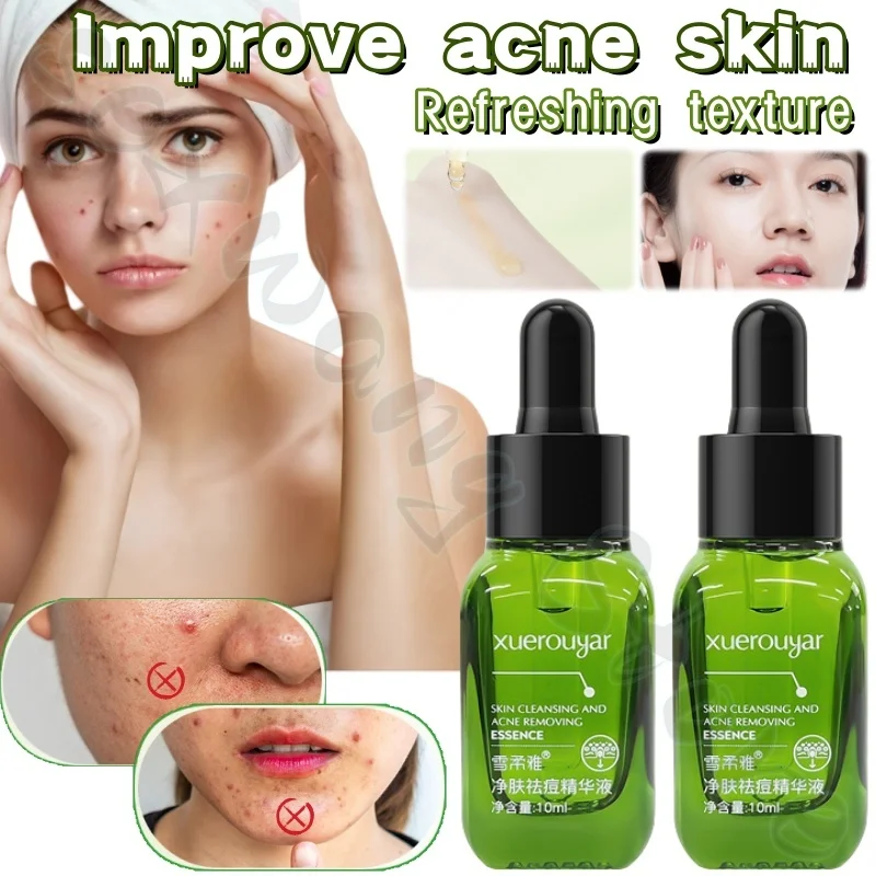 

Small green bottle skin cleansing essence 10ml high moisturizing moisturizing and refreshing to improve acne rough skin