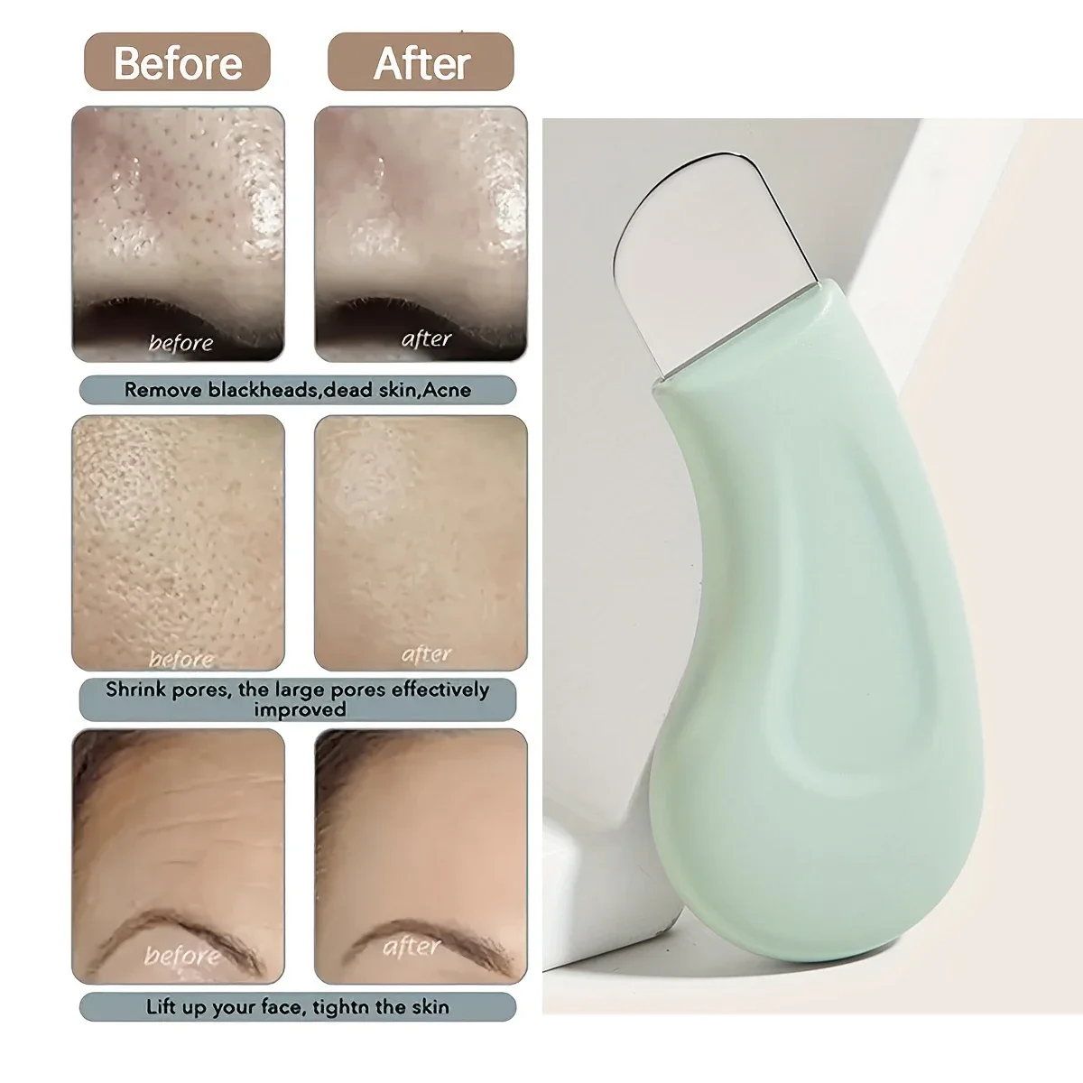 Herramienta para Eliminar Puntos Negros y Blancos de la Nariz y el Rostro - Limpiador de Poros de la Piel, Herramientas de Belleza para el Cuidado de la Piel