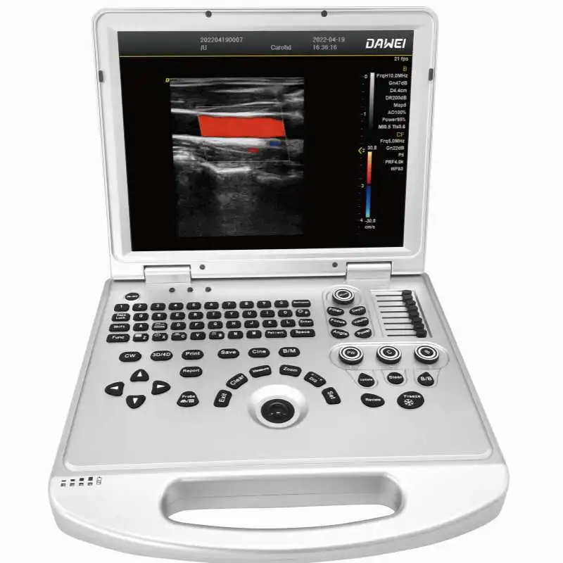 portable Color Doppler 2D general ob&gyn urology ultrasound DW-L3