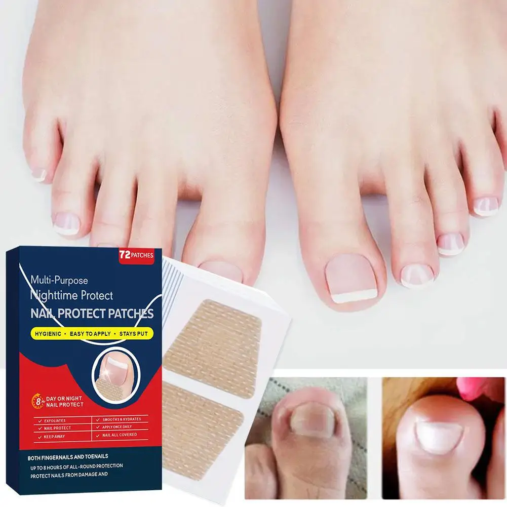 72Pcs/Box Toenail Fungus Patch Breathable Nail Repair Patches Nail Ingrown Correction Stickers Waterproof Sticky Foot Care NEW