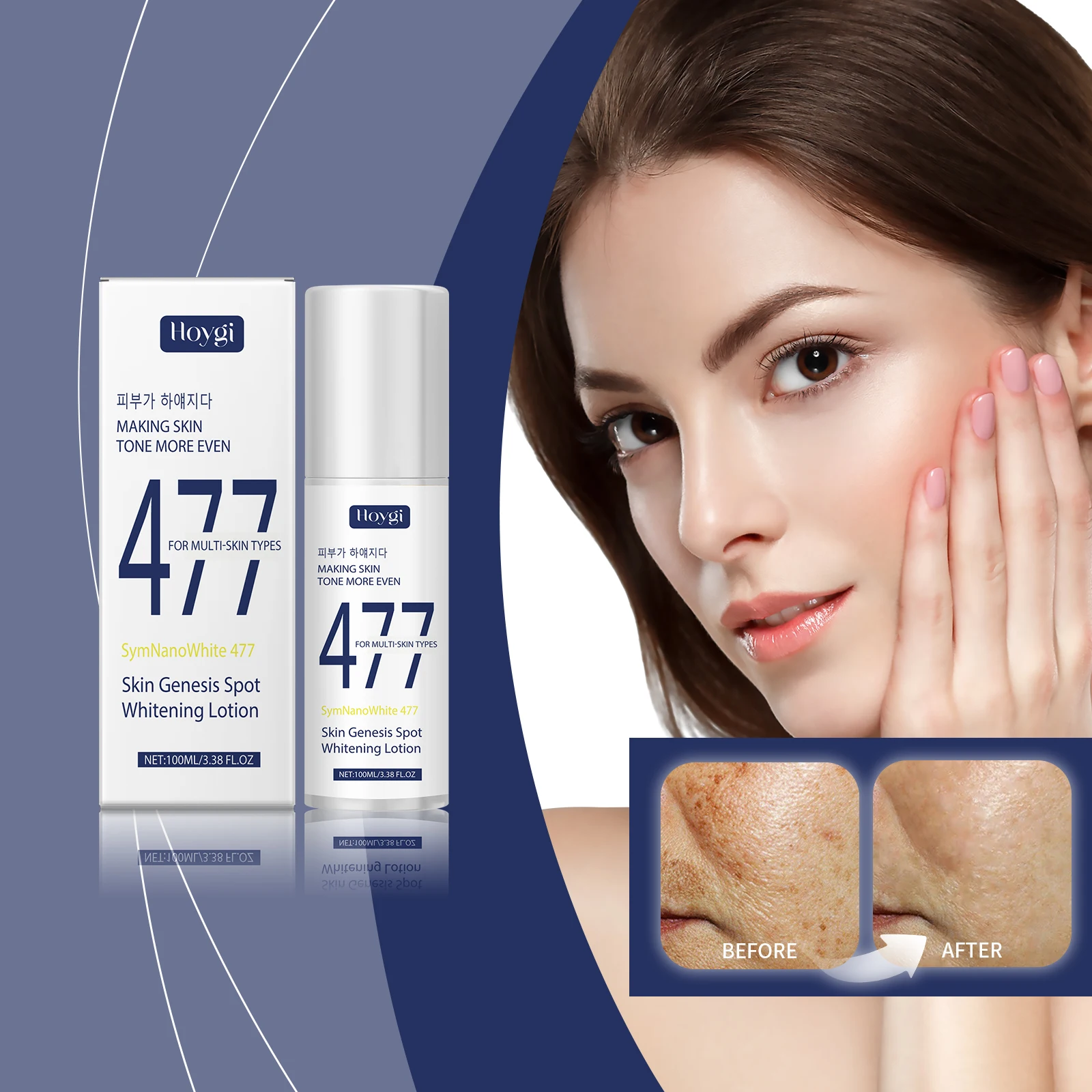 SymNanoWhite 477 Whitening Lotion for Even Skin Tone - Dark Spot Corrector, Brightening Treatment for Face & Body,