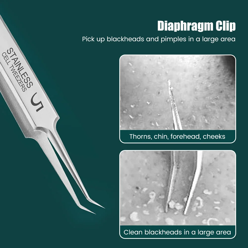ドイツの極細No. 5 セルニキビにきびクリップピンセットビューティーサロン特別なスクレーピング & クロージングアーティファクトにきび針ツール