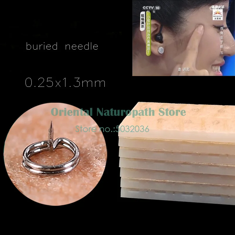 10 Boxes Sterile Ear Press Needles Auricular Fine needle Beauty Freckle Acupuncture with Paster Disposable 0.25*1.3mm