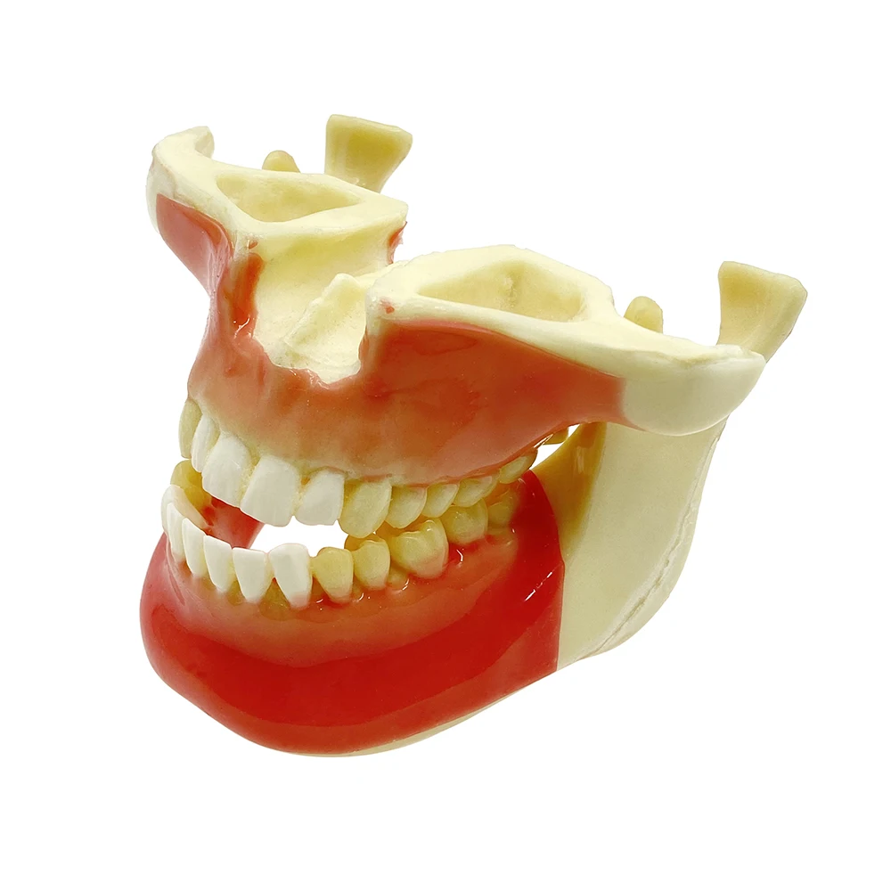 Ortho Implant Model Dental Study Teaching Exercise for Student Dental Teaching Model Pathological Demonstration Teeth Model