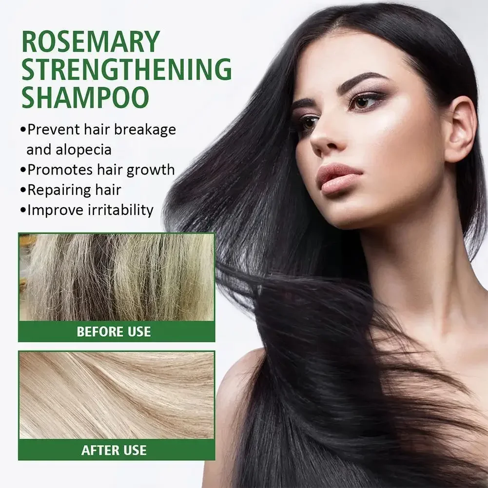 Sdotter New Rosemary Strengthening Shampoo and Rosemary Hair Oil Promote Hair Repair Nourishment Root Hair Deep Anti Loss Шампун