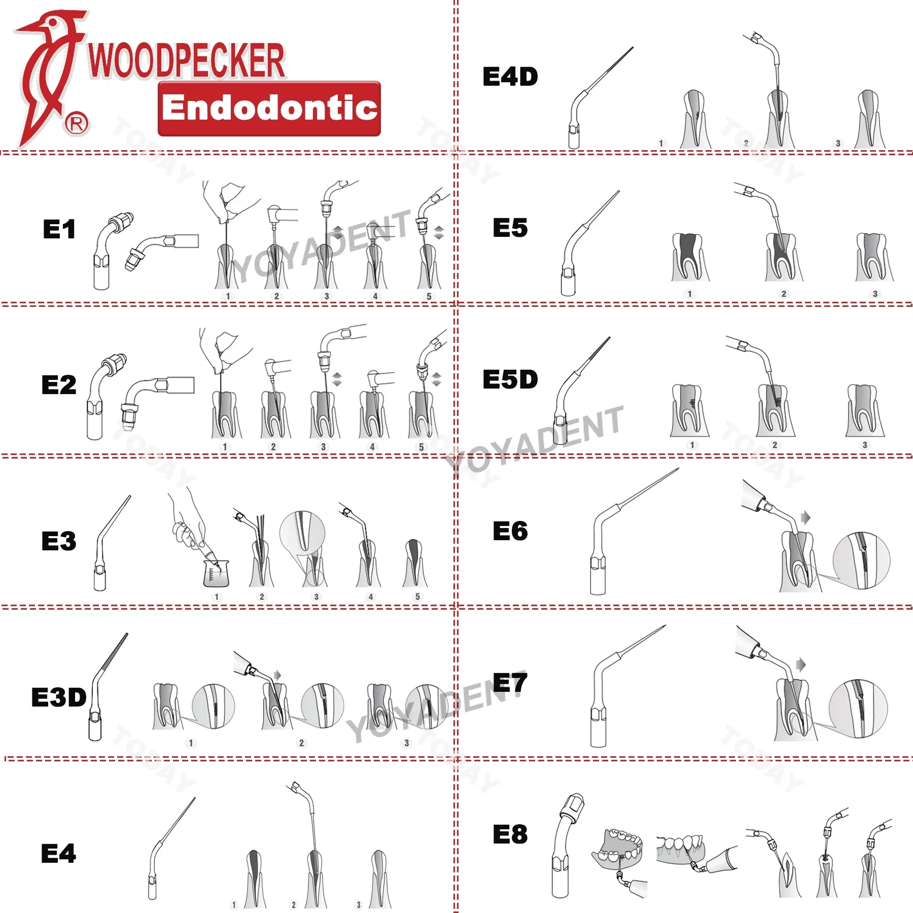 Woodpecker DTE Dental Ultrasonic Endodontics Scaler Tips Root Canal Treatment Dentist Tools Fit SATELEC NSK EMS Scaler Handpiece