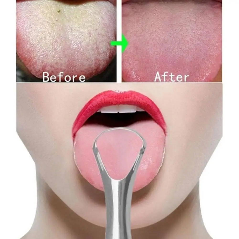 1 stücke Zungen schaber Bürste Edelstahl Zungen reiniger Werkzeuge Entfernungs werkzeug Atem umwelt freundliche Atem schlechte Bürste oral d5n4