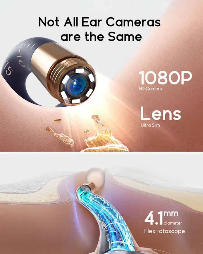 Nettoyeur D'oreilles Visuel Bebird EarSight 3 Plus - HD Incurvable Clipsable - Neuf - Aluminium