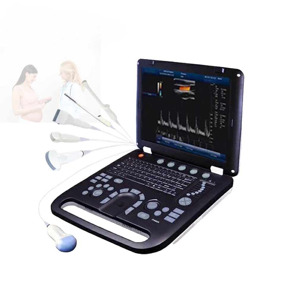 Medical Professional Obstetric doppler ultrasound device 3D 4D color ultrasound scan system