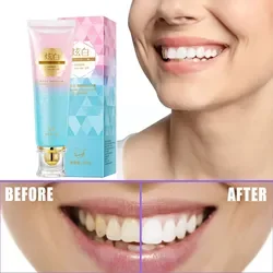 Pasta de dientes blanqueadora de niacinamida, ayuda a el cuidado bucal, malas alientos, eliminación de manchas, reduce la placa, pasta de dientes para mujeres y hombres, 1 ud.