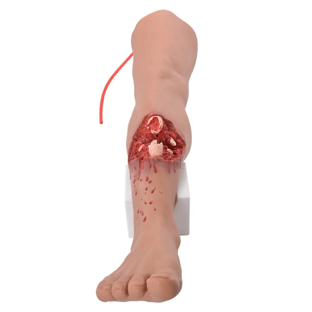 Ultrassist Open Tibial Fracture Leg Wound Simulator with Integrated Bleeding System 1:1 Life-Size for First Aid Trauma Education