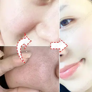 水楊酸毛孔清潔霜 收縮毛孔 去除黑頭粉刺 提亮膚色 保濕柔滑肌膚 韓國產品 10 最佳銷售 韓式奶油 - №2