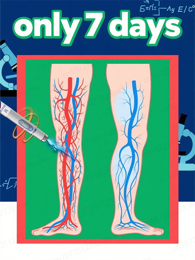 

Laser removal of varicose veins, healthy skin